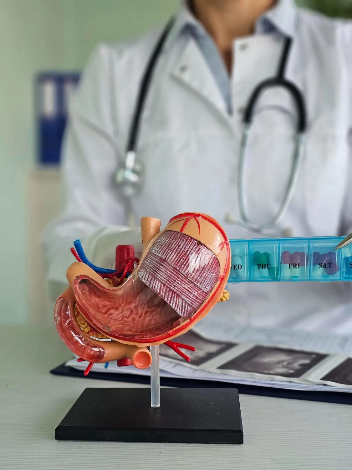 preguntas gastroenterologia cdmx